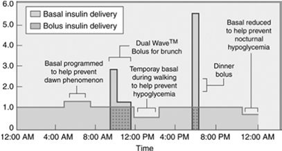 Rodzaj insuliny NPH Humulin N Insulatard Insuman Basal (Sanofi Aventis) Gensulin N (Bioton) Polhumin N (Polfa Tarchomin) Początek Szczyt Insuliny o pośrednim czasie 2-4 godz. 5-6 godz. 10-16 godz.