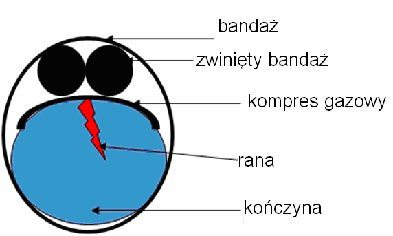 KRWAWIENIA: Zaopatrywanie krwawień: Zawsze materiałem jałowym, czystym, niestrzępiącym się (czyli gazą, a nie watą) Nie dezynfekować, nie wlewaj do rany tego czego nie wlałbyś sobie do spojówki oka