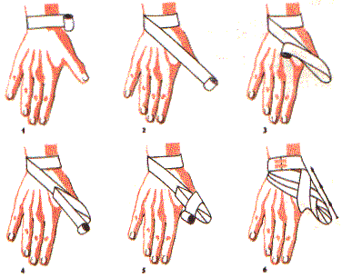 BANDAśOWANIE W stanach