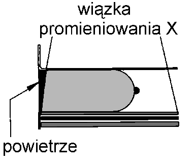 Promieniowanie opuszczające lampę przechodzi przez metalowy filtr kształtujący widmo wiązki, układ kształtujący wiązkę oraz płaszczyzny ściskające pierś.