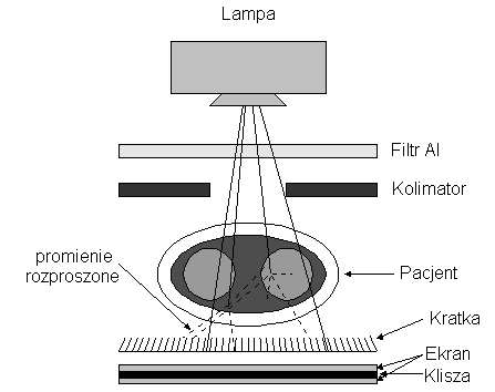 Konstrukcja aparatu RTG W najprostszym wykonaniu aparat radiologiczny składa się z generatora wysokiego napięcia, lampy