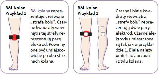 Jedna para elektrod (kwadraty białe) umieszczona jest wewnątrz strefy bólu jedna z przodu, druga z