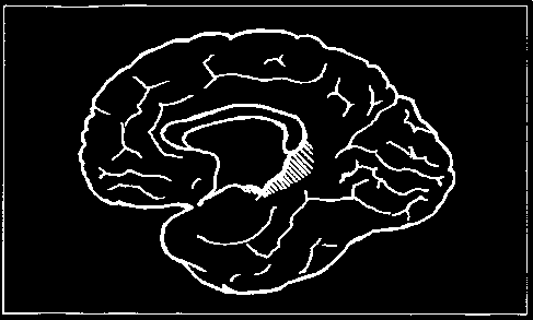 Zaburzenia w płatach skroniowych stanowią niejednokrotnie wskazówkę o specyficznej formie epilepsji, tak zwanej epilepsji psychomotorycznej lub inaczej padaczki skroniowej (epilepsia temporalis, TLE).