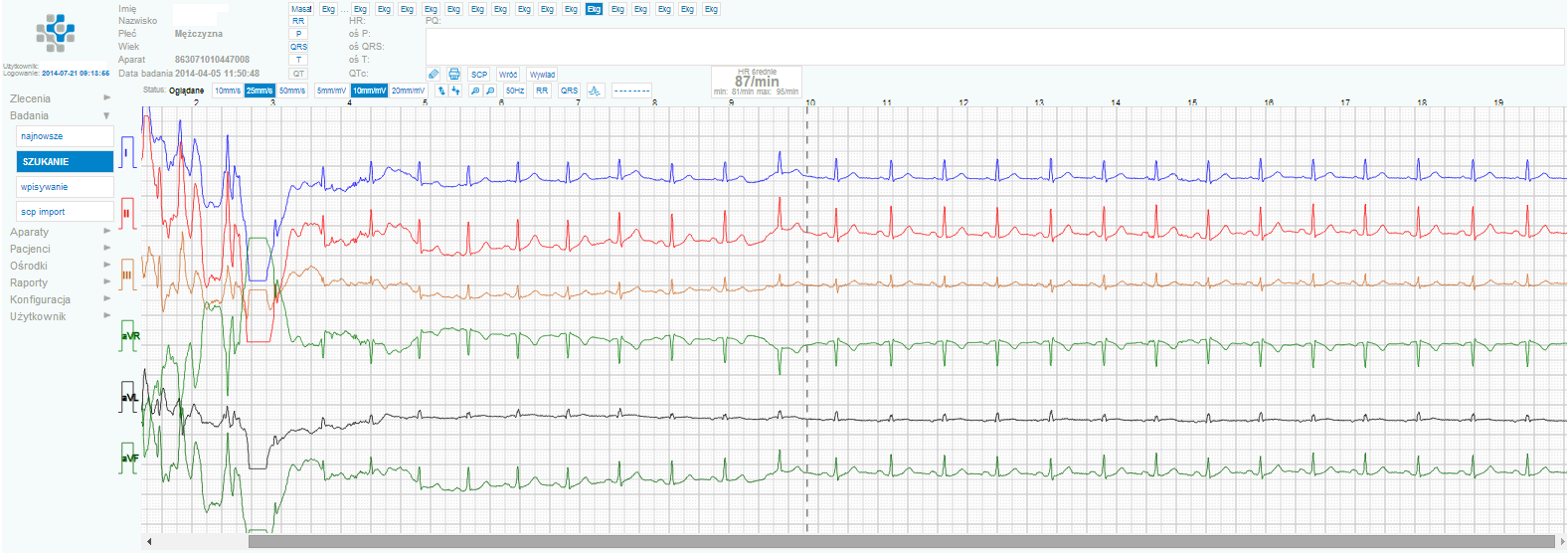 Kardio : zdalne monitorowanie pracy serca Aparat rejestrujący sygnał EKG + Sieciowa platforma telemedyczna: dla lekarzy (z przeglądarką EKG) i dla pacjentów + Transmisja sygnału EKG poprzez GSM +