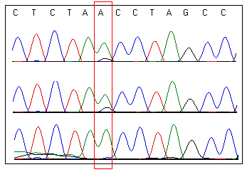 Wyniki m.3635g>a A B C Rysunek 13. Elektroforegramy regionów otaczających mutację m.3635g>a w mtdna. Czerwonym prostokątem zaznaczono miejsce występowania mutacji m.3635g>a. Obecność mutacji m.