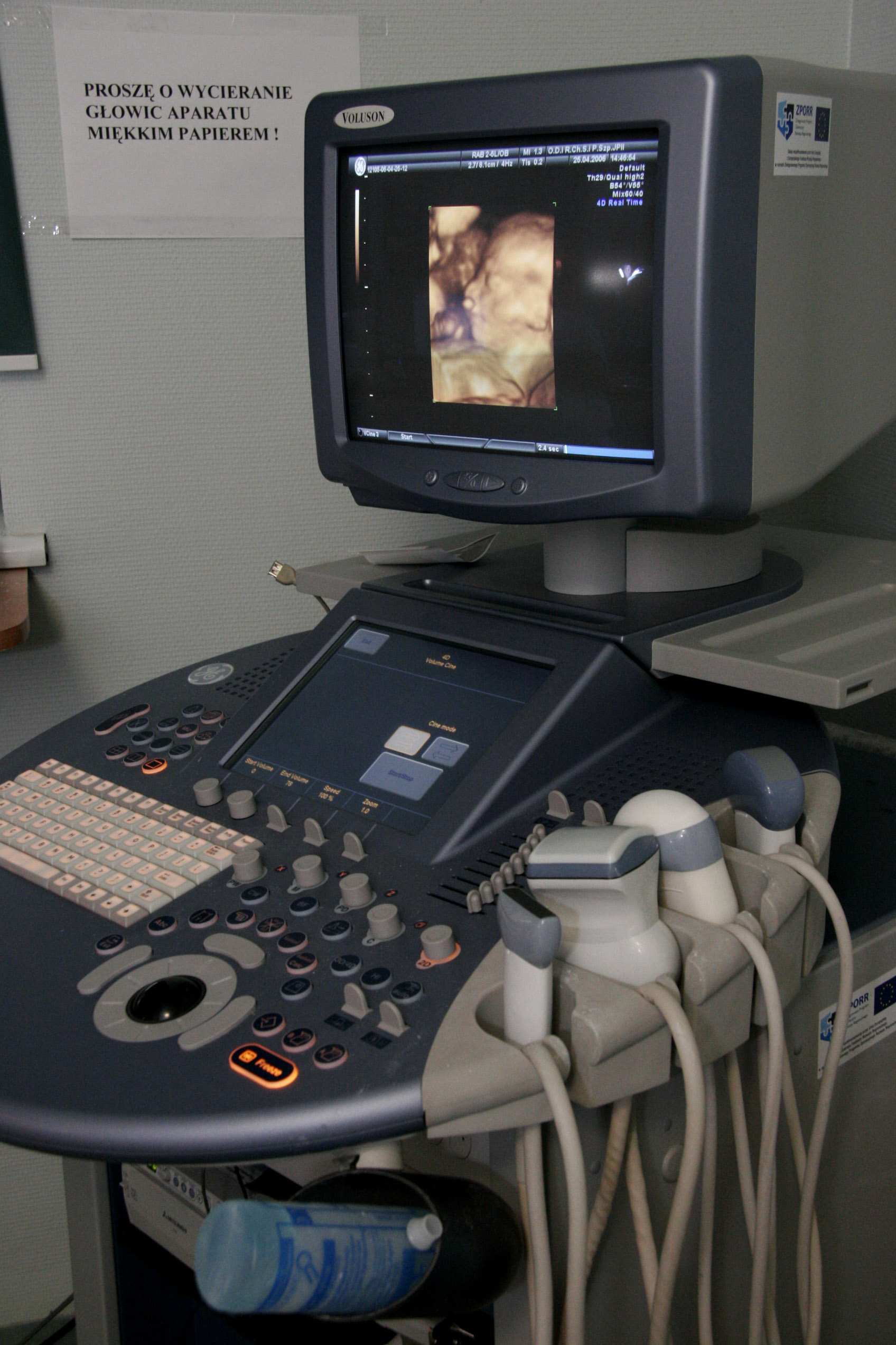 Zintegrowany Program Operacyjny Rozwoju Regionalnego 2004-2006 Ucyfrowienie systemu echokardiograficznego i mammograficznego w Cele: zakup mammografu z przystawką cyfrową, modernizacja