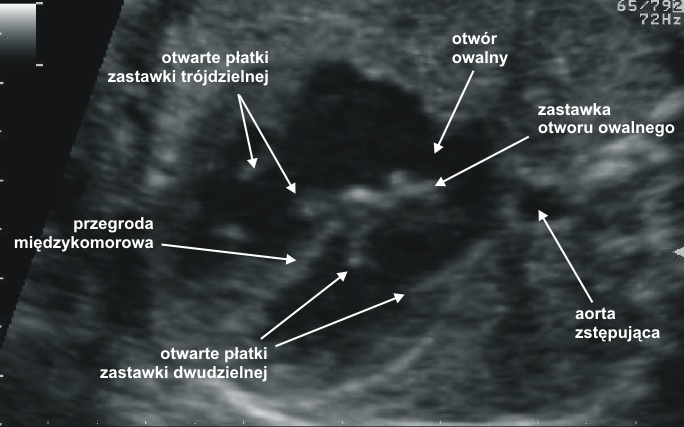 ANATOMIA