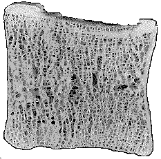 Inżynieria Biomedyczna