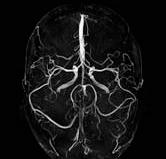 Pakiet Angio Pakiet Angio 1) jest także elementem zestawu aplikacji dla systemu Tim. Umożliwia on wykonywanie za pomocą rezonansu magnetycznego angiografii doskonale obrazujących tętnice i żyły.