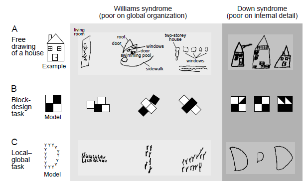 Syndrom Williamsa ( WMS)