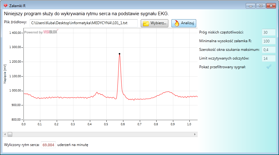 Rysunek 9 Interpretacja Analizy EKG Wszystkie wykryte przez algorytm załamki R oznaczane są w postaci czarnych kropek. Na dole wyświetlona zostaje wyliczona ilośd uderzeo serca pacjenta na minutę.