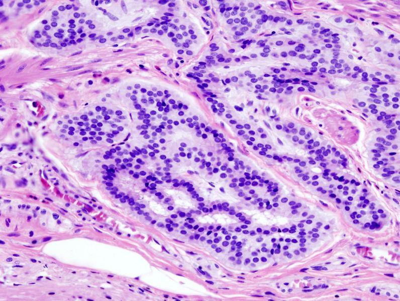 prostaglandyn działa przeciwoksydacyjnie hamując mutacje DNA Te mechanizmy zapobiegają rakowi jelita grubego