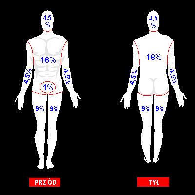 zagrażające życiu są oparzenia głębokie > 20%