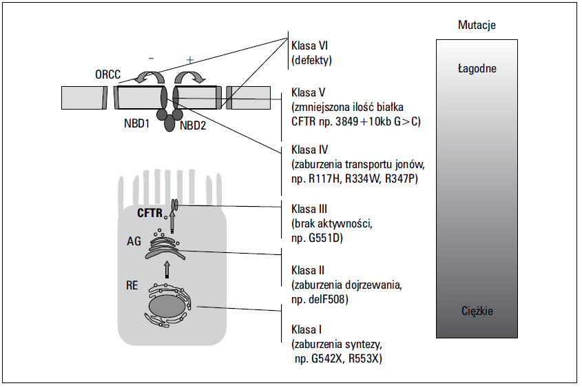 ORCC (ang. Outwardly Rectifying Chloride Channel). NBD (ang. Nucleotide Binding Domain) domena wiążąca nukleotyd. Rycina 1. Klasy mutacji genu CFTR Tabela 2.