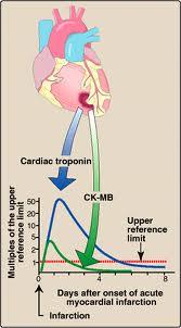 (CK-MB) ok. 5% CK-3 (CK-MM) ok.