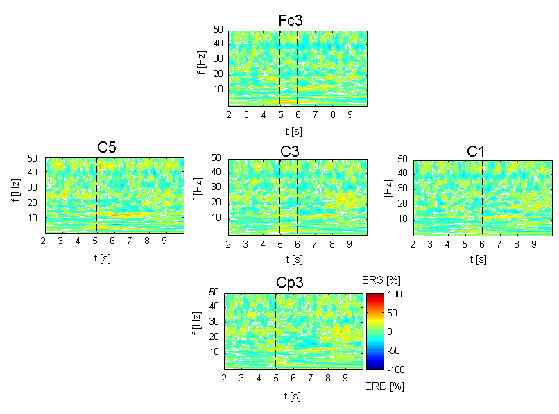 Analiza sygnału EEG związanego z wyobrażeniem ruchu 5.1.4 Filtracja przestrzenna Na rysunkach 5.9 oraz 5.