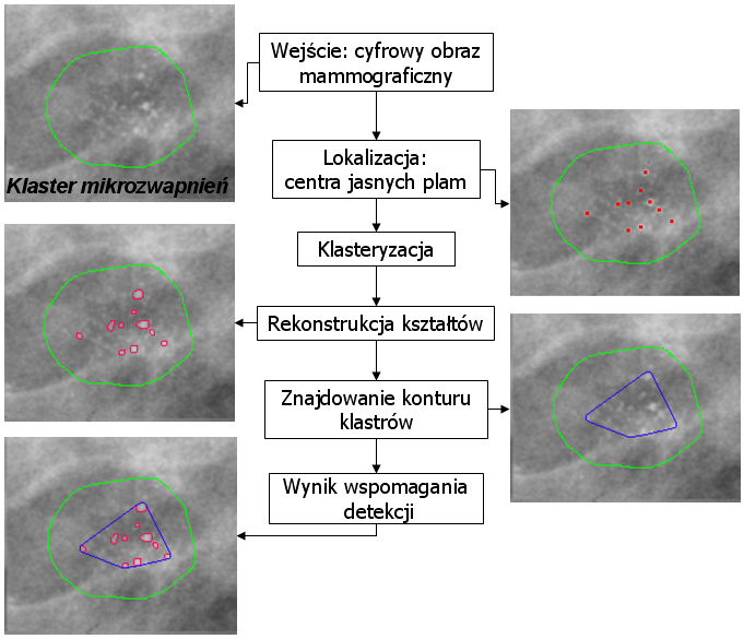 3.5. DETEKCJA KLASTRÓW POTENCJALNYCH MIKROZWAPNIEŃ Rysunek 3.