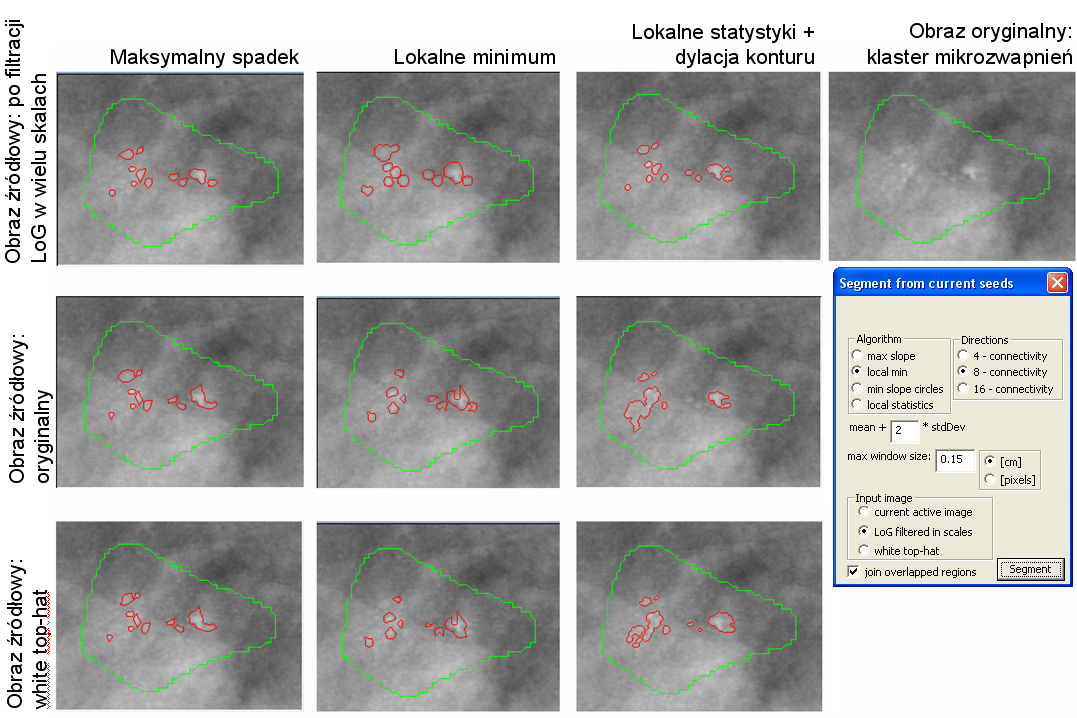 ROZDZIAŁ 3. SYSTEM WSPOMAGANIA DIAGNOSTYKI MAMMOGRAFICZNEJ MAMMOVIEWER Rysunek 3.