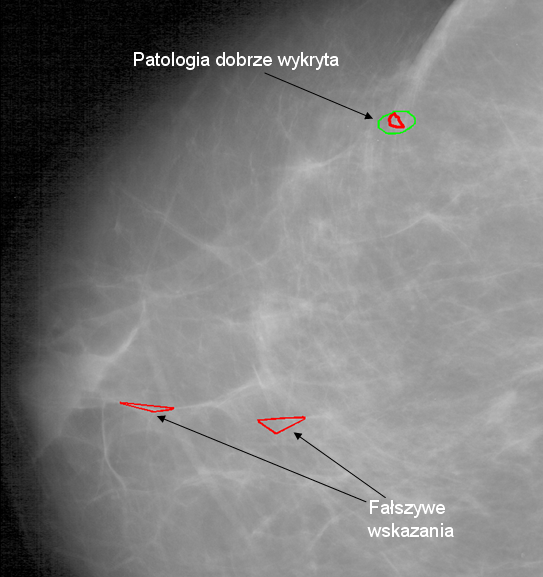 ROZDZIAŁ 4. EKSPERYMENTY Rysunek 4.