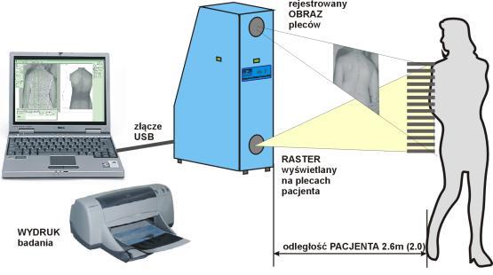 Komputerowe Badanie Postawy Ciała Aparatura do Komputerowej Oceny Postawy Ciała jest narzędziem pozwalającym na nieinwazyjną, dokładną i obiektywną diagnostykę postawy ciała.