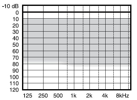 M W O karta pacjenta rezultat 1; odlew ucha rezultat 2; instrukcja dobranego aparatu rezultat 3; audiogramy rezultat 4; przebieg wykonania odlewu ucha i badania audiometrycznego w odniesieniu do D w