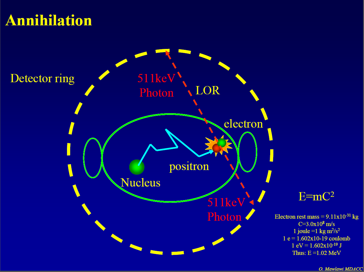 Metoda PET oparta jest na zjawisku anihilacji elektronu i pozytonu,