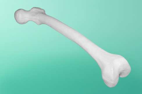 Kość udowa lewa o długości 450 mm w wersji materiałowej A, Numer katalogowy 30-1000A Kość udowa lewa o długości 450 mm w wersji materiałowej B, Numer katalogowy 30-1000B Kość udowa lewa o długości