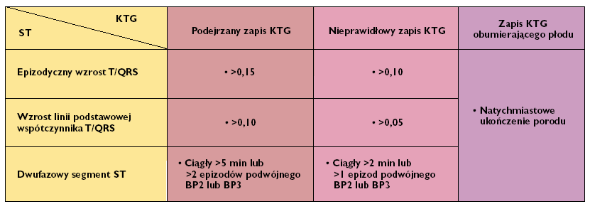 EKG