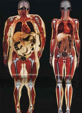 Związane z wiekiem zmiany w składzie ciała (2) Z wiekiem: zmienia się dystrybucja tkanki tłuszczowej: jej większe depozyty lokalizują się w obrębie jamy brzusznej, oraz w