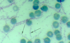 cholery Borrelia