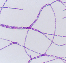 bakterii typu coli np. E.
