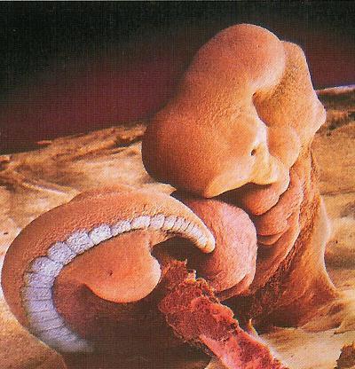 Prawidłowy rozwój wewnętrznych, żeńskich narządów płciowych wyprzedza (o 1 tydzień) rozwój żeńskich gonad. Dalej biegnie równocześnie.