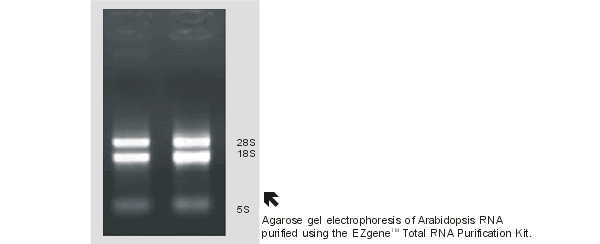 Biblioteki DNA/cDNA Izolacja RNA wolnego od DNA w celu