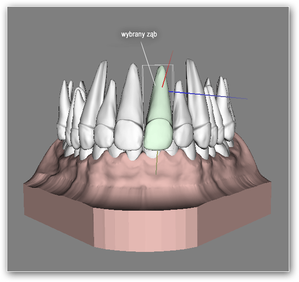 12.2. Wybór zęba Aby wybrać ząb, którego położenie ma być skorygowane należy kliknąć na nim prawym przyciskiem myszy lub dwukrotnie kliknąć jego nazwę na liście podobiektów w zakładce "Podobiekty".