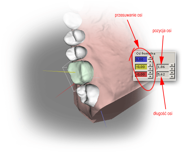 Kolory pól numerycznych odpowiadających za przesunięcie korespondują z kolorami osi lokalnego układu współrzędnych zęba. Pozostałe parametry mają wpływ na ruch zęba.