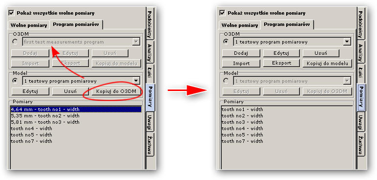 Program pomiarowe mogą być dostarczone na 2 sposoby : z modelem z programem O3DM Model szczęki pacjenta może zawierać szereg informacji oprócz kształtu samego modelu. W pliku modelu zapisywane są np.