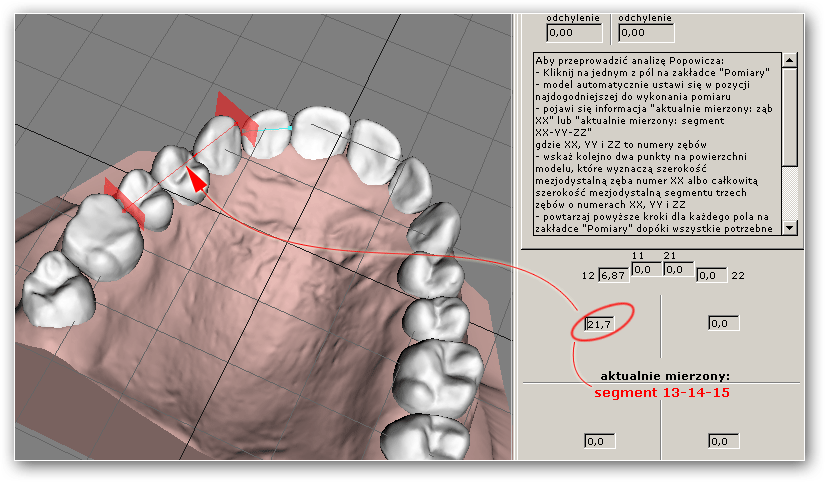 11.3. Pomiar szerokości segmentu zębów Do wykonania niektórych analiz konieczne jest podanie szerokości segmentu, czyli łącznej szerokości kilku sąsiadujących zębów.