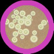 Penicillium v Saccharomyces Grzybice skóry Stachybotrys Max Rozmiar (nm)... 5000 Max Rozmiar (nm)...10,000 Max Rozmiar (nm)...15,000 Max Rozmiar (nm)...72,000 Liczba gatunków.