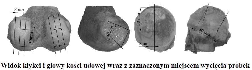 Zaburzenia tarcia (patologia) Widok stanowiska badawczego: 1 uchwyt dolny, 2 próbka dolna, 3 uchwyt górny, 4 próbka górna, 5 dźwignia obciążająca, 6 czujnik przemieszczenia, 7