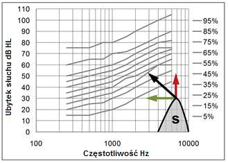 Jak wykorzystać Test Percepcji Fonemów do poprawy dopasowania Test Percepcji Fonemów zapewnia wyniki, które w sposób kompleksowy wskazują możliwości słyszenia pacjenta oraz słabe i mocne strony