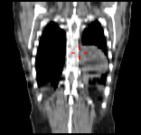 PET/CT) Detektory SPECT Lampa rtg (CT)