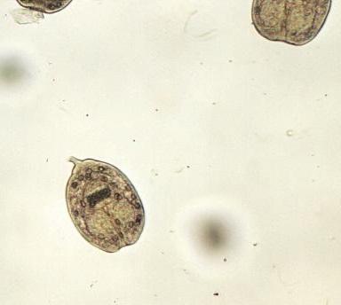 protoskoleksy Serologia, PCR Różnicowanie z CCA Leczenie Praziquantel