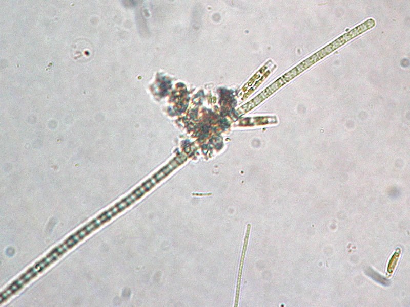 Tak wyglądają sinice pod mikroskopem Microcystis aeruginosa Aphanizomenon flos-aquae Niestety sinice produkują też substancje toksyczne.
