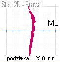 Przykładowy badany Przykładowy badany Oznaczenia: MaxAPF MaxAPF LR MaxAPF LL MaxAPB MaxAPB LR MaxAPB LL SMF LR SMF LL SMB LR SMB LL FL LR FL LL Przedni zakres stabilności (Maxima Antero Poserior