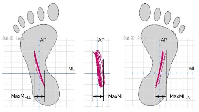 Przykładowy badany Przykładowy badany Oznaczenia: MaxML MaxML LR MaxML LL Ryc. 8.