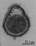 CHELICERATA KLESZCZE powodują infekcje Acarida: Ixodina pedipalpi chelicerae