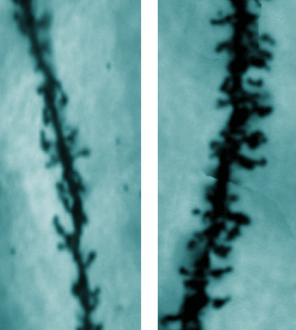 Synaptogeneza: 2 Typy synapsów lekcja z Fragile X Forma upośledzenia umysłowego : 1/2000 mężczyzn Niefunkcjonalność genu FMR1 uniemożliwia usuwanie