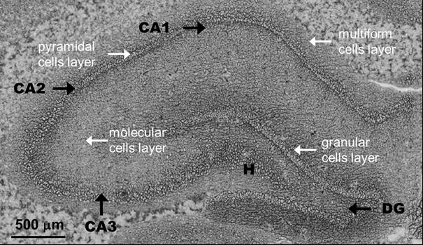 Materiał badawczy Formacja hipokampa Obraz