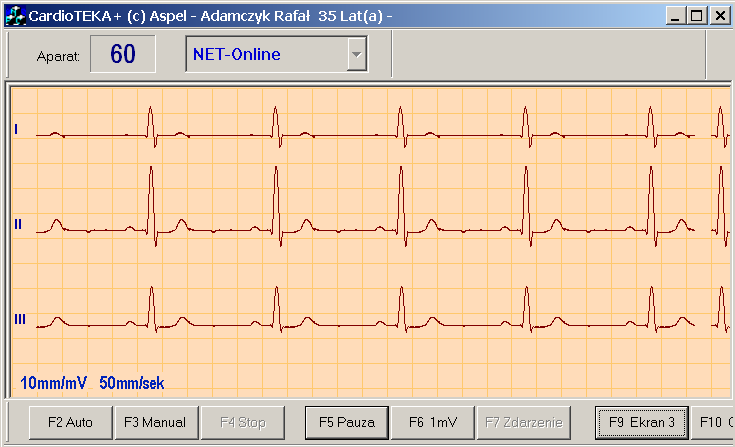 Konsola górna Parametry EKG Konsola dolna R Rys 7. Moduł podglądu sygnału EKG Opis Modułu Pasek tytułu okna modułu Podgląd EKG zawiera informacje o aktualnie wybranym pacjencie.