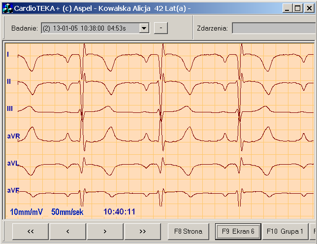 Rejestracja (zapis) EKG Moduł EKG po uruchomieniu wyświetla sygnał w sposób ciągły. Zapis badania do bazy moŝe odbywać się w dwu trybach: AUTO i MANUAL.